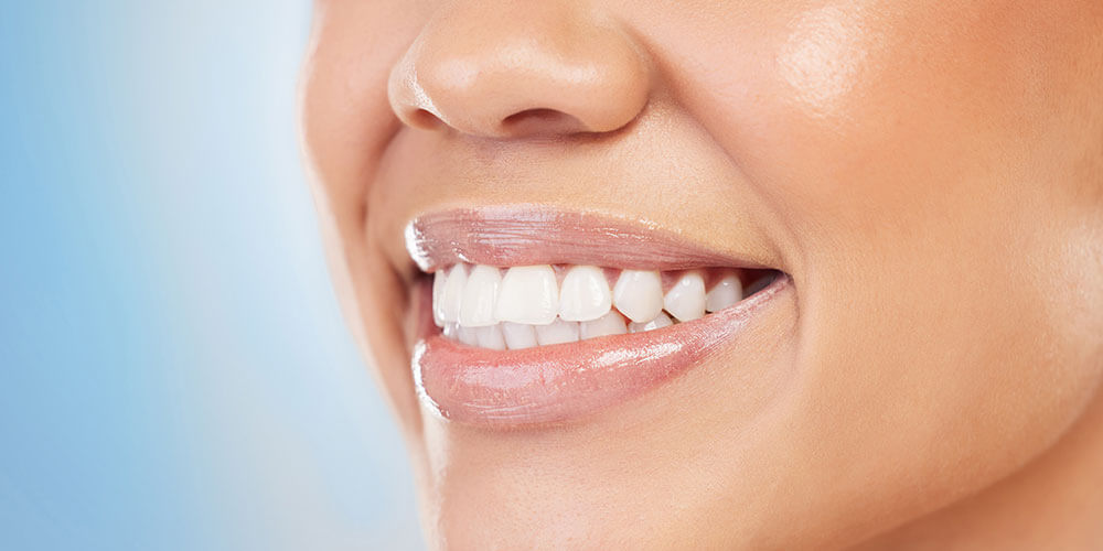 Fluoride Treatment Edmonton